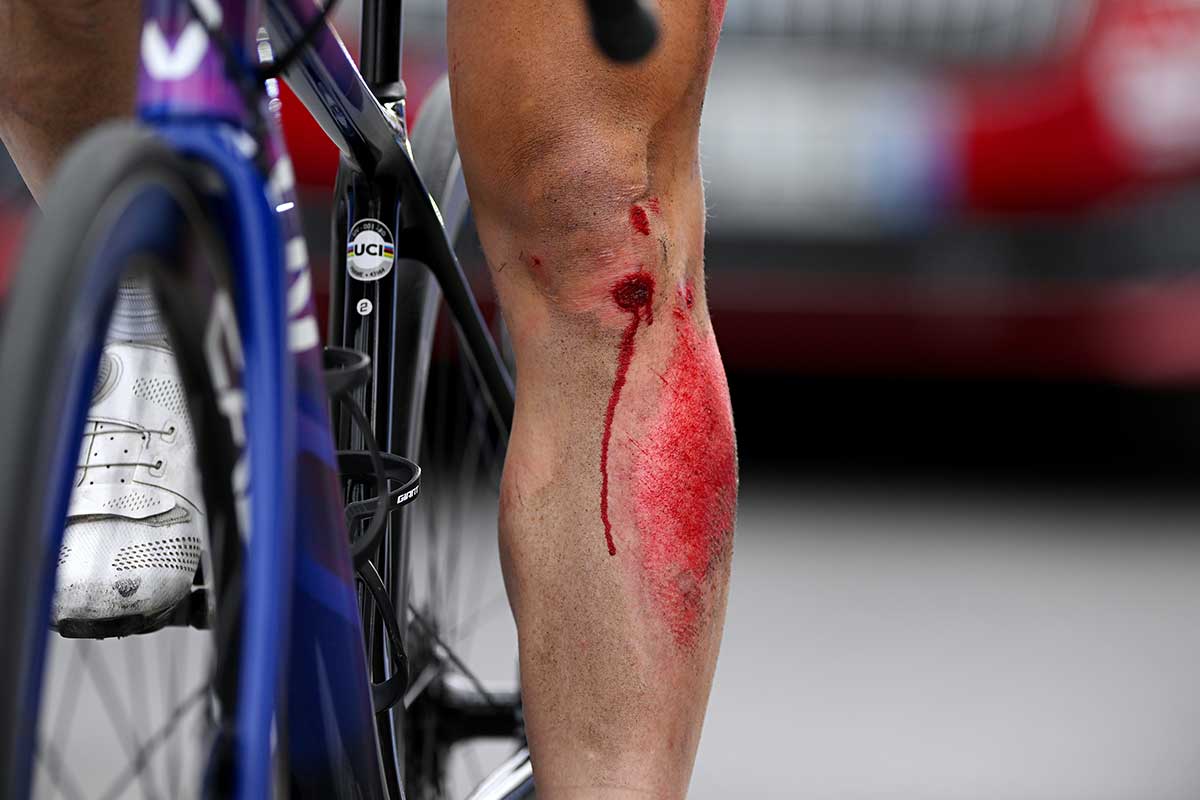 Opinion: Individuals aren’t to blame for crashes at the Tour de France Femmes, it is part of bike-racing